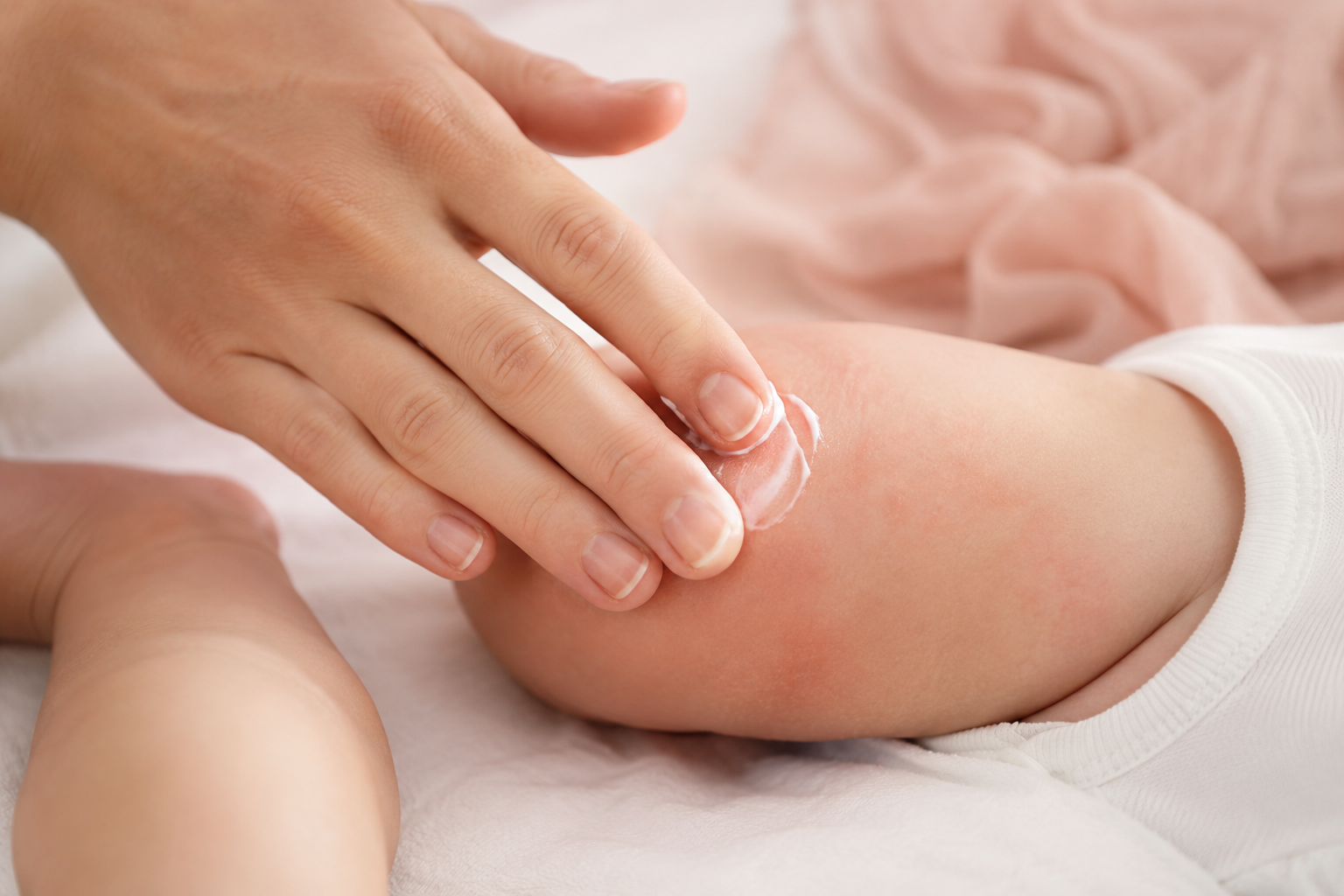 Main d'une maman appliquant délicatement une crème hydratante sur la peau légèrement irritée liée à l'eczéma du nourrisson de son bébé dans une ambiance douce et rassurante.